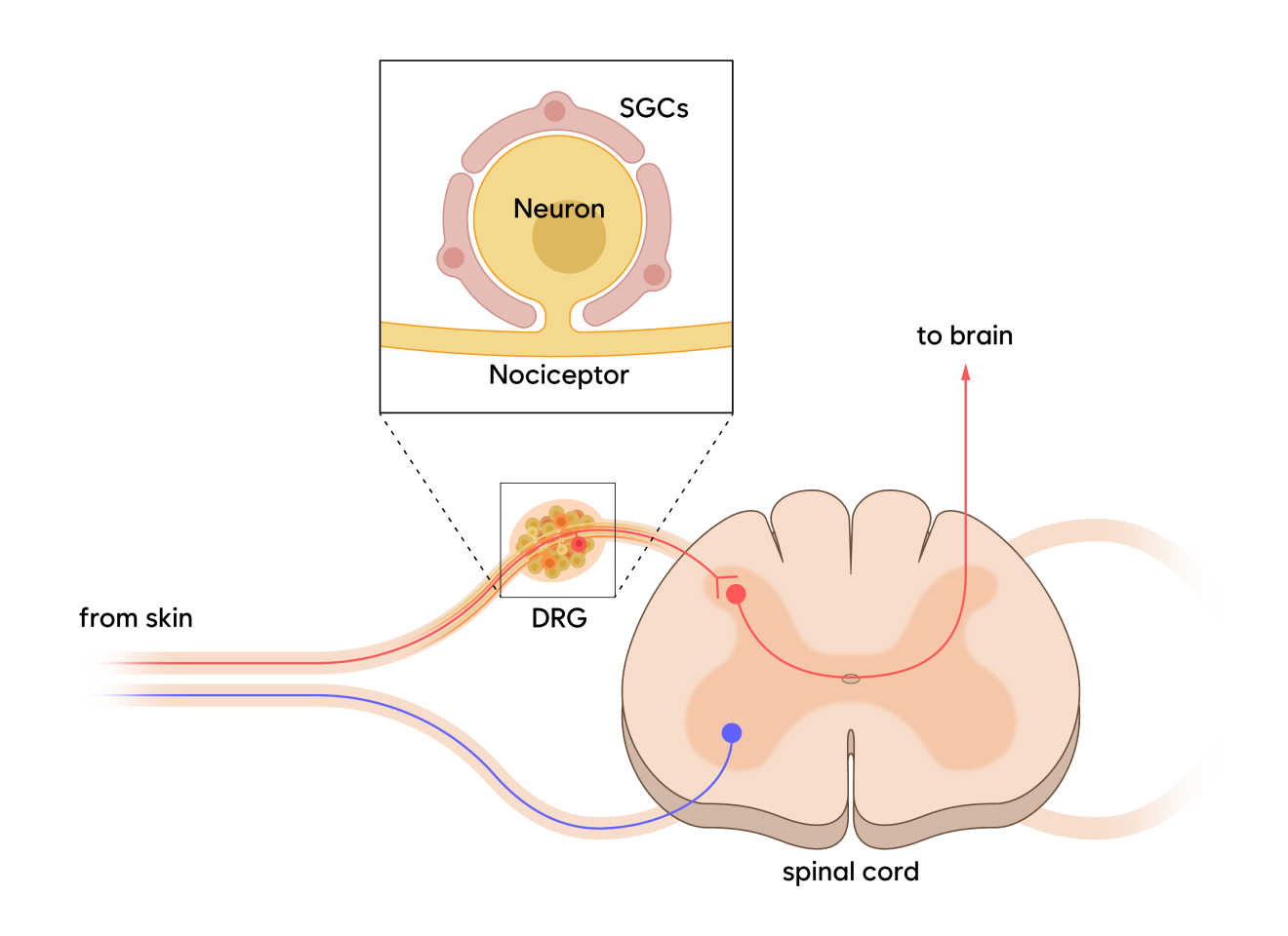 Chronic pain pathway: sensory neurons, DRG, satellite glial cells, and pain signaling to the brain